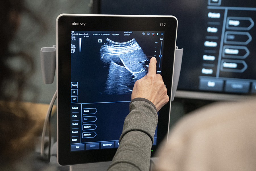 Ultrasound Display