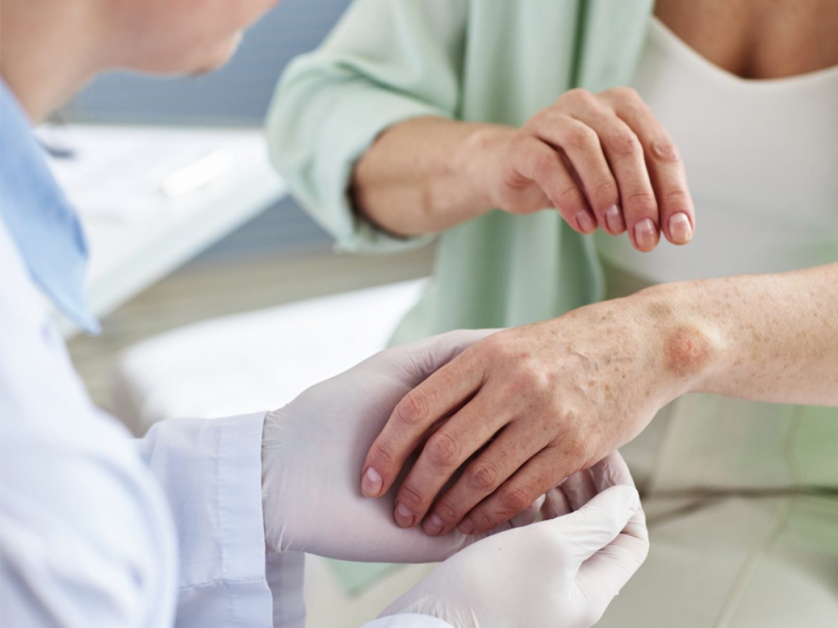 nurse examining patient's arm